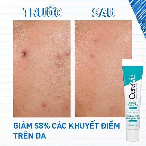 cach-tri-mun-2-ben-ma-tai-nha-12